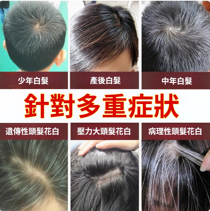 天然何首烏純植物黑髮洗髮精柔順順滑烏髮液少年中老年洗髮液