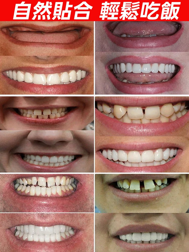 【美國製造，FDA認證】訂製全口義齒套裝，專業定制貼合舒適，讓健康美齒成真，現在下單享額外禮遇！